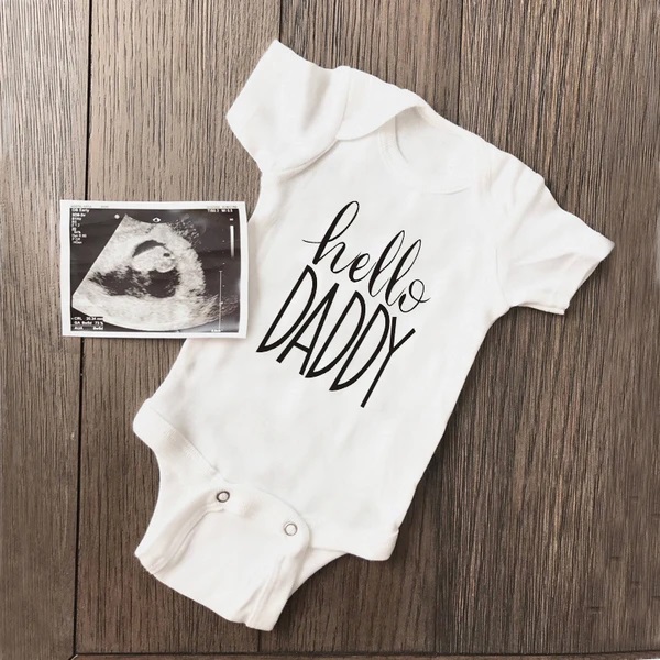 Baby Clothing Online - Комбинезон для мальчиков и девочек, летний,